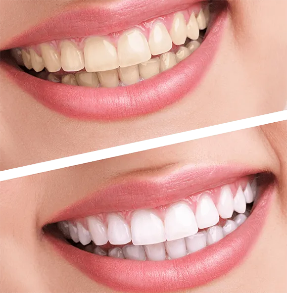 What a difference!